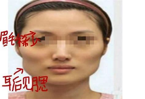 腮骨大 面相|腮骨大的女人面相 好不好